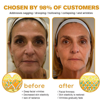 (Made and Shipped from USA) 🧑‍⚕️TLOPA® Botox Bee Venom Wrinkle Removal Cream- LAST DAY 70% OFF🔥
